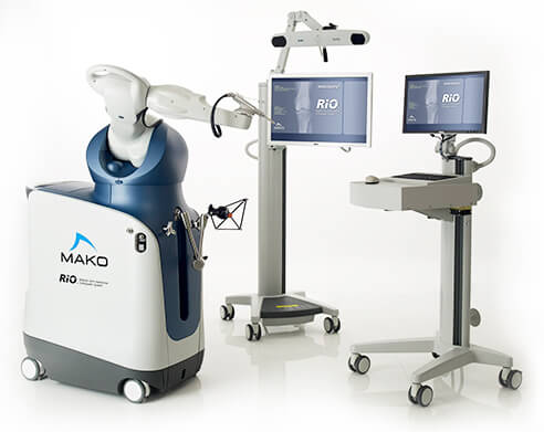 rio_fullkneesystem1 rio_fullkneesystem