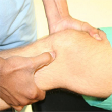 acl-1